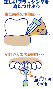 正しいブラッシングで、歯を守ろう